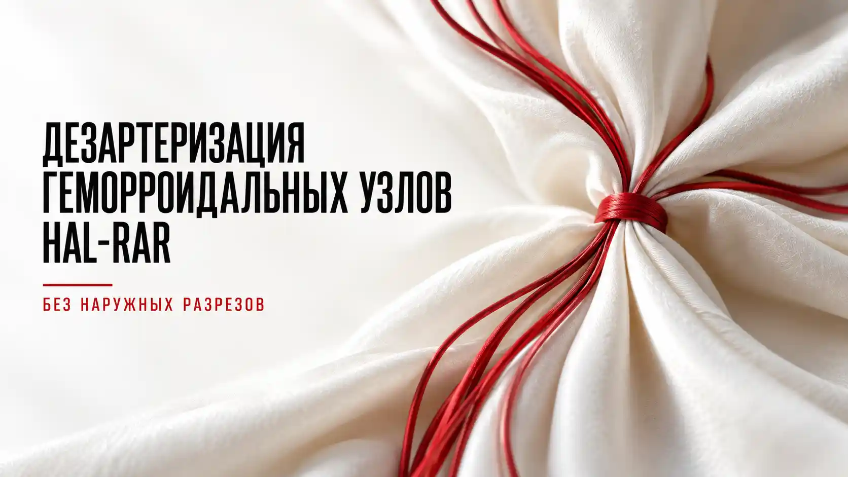 Дезартеризация геморроидальных узлов 