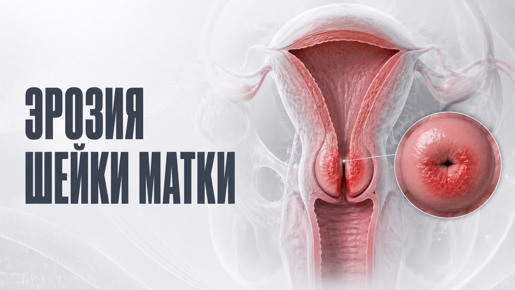 Диагностика и лечение эрозии шейки матки в Хабаровске — клиника «Нефертити»
