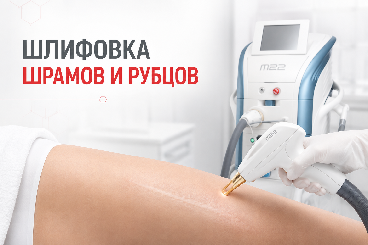 Лазерное удаление рубцов в клинике Нефертити, Хабаровск