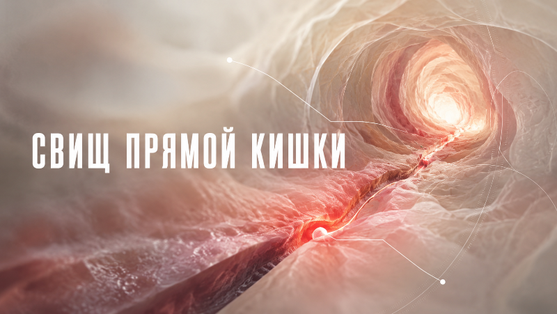 Свищ прямой кишки: почему появляется и как его лечат