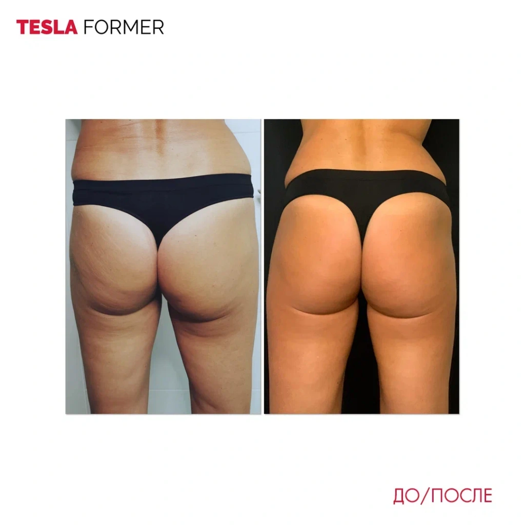 Tesla Former до и после