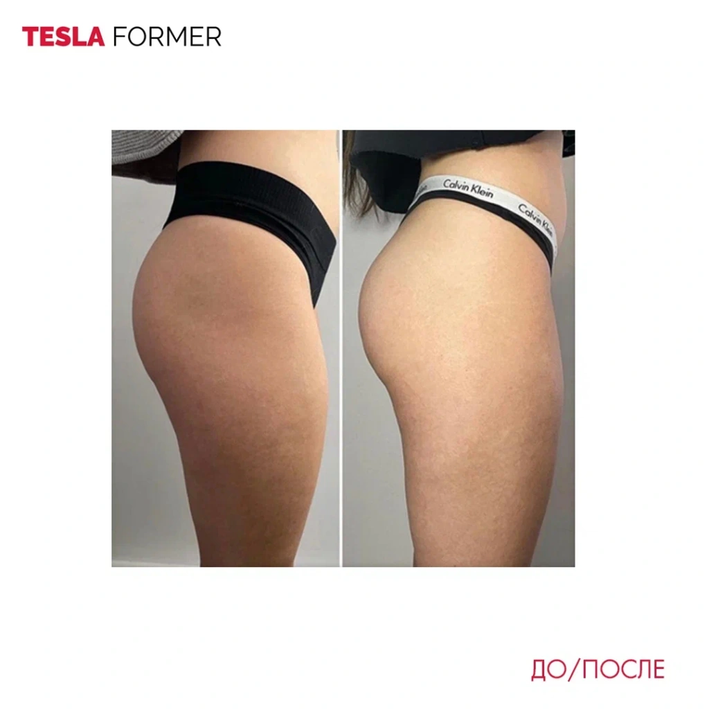 Tesla Former до и после
