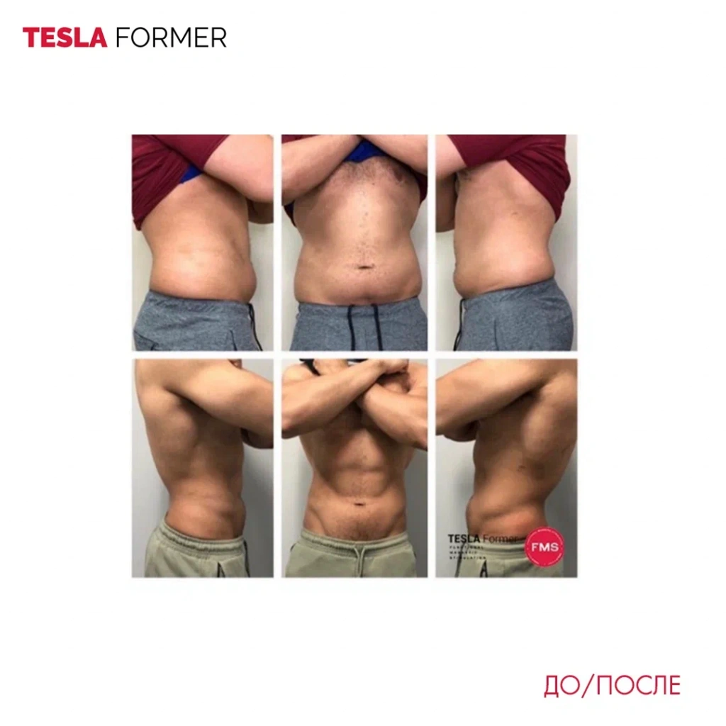 Tesla Former до и после