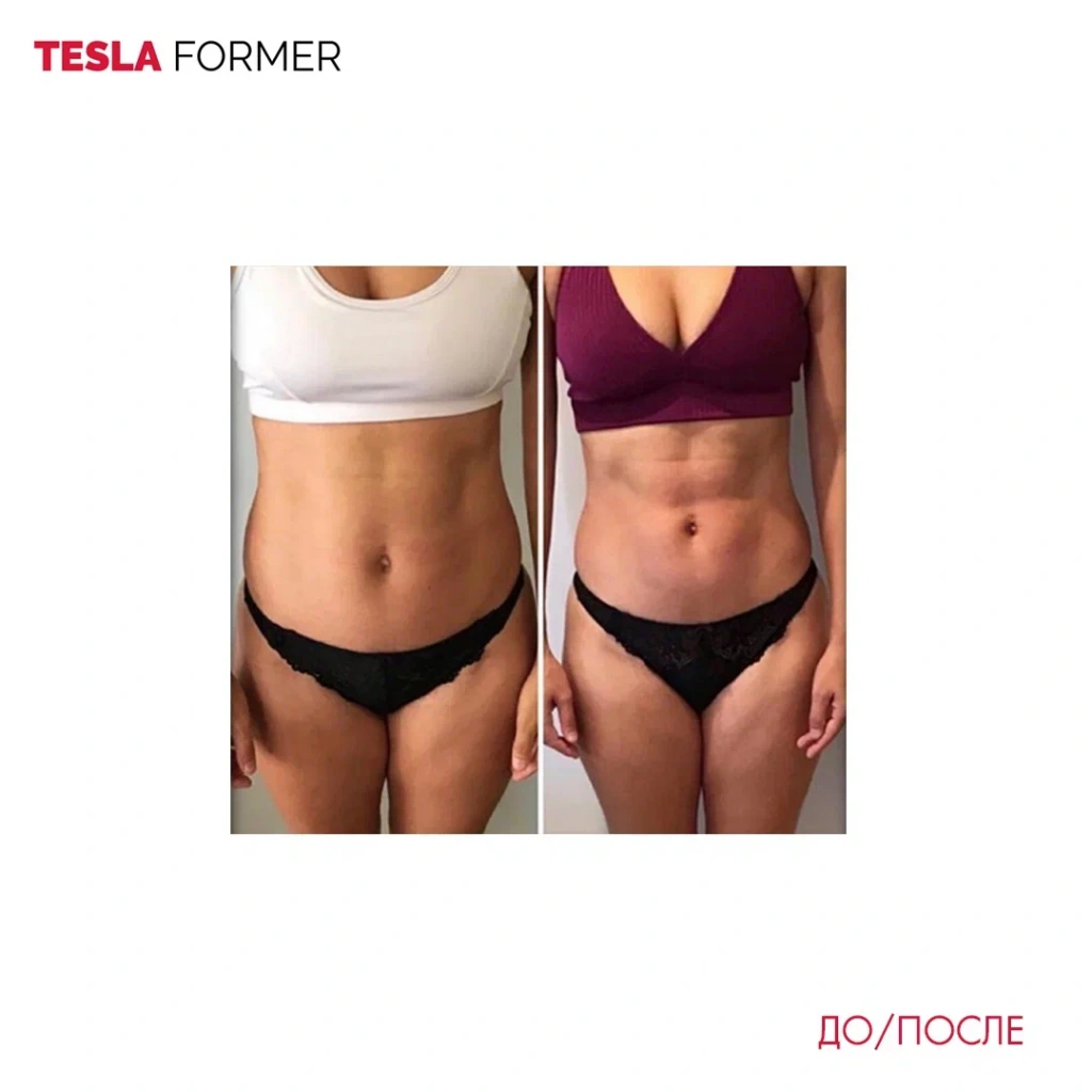 Tesla Former до и после
