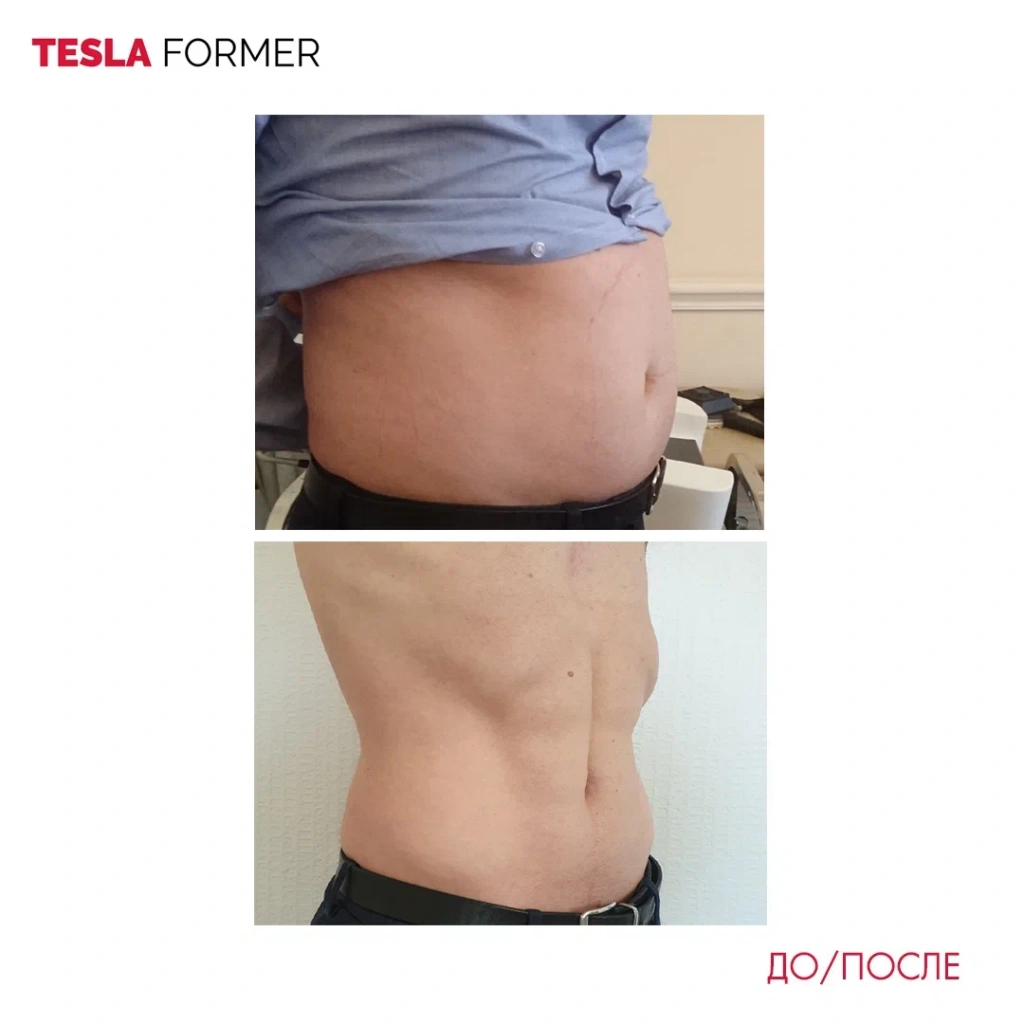 Tesla Former до и после